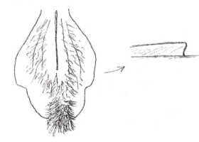 Dendrobium curvisepalum: Dendrobium curvisepalum Ridl., drawing by Paul Ormerod, based on the holotype Kloss s.n. (Camp 6a, 3100 ft.) (holo BM).